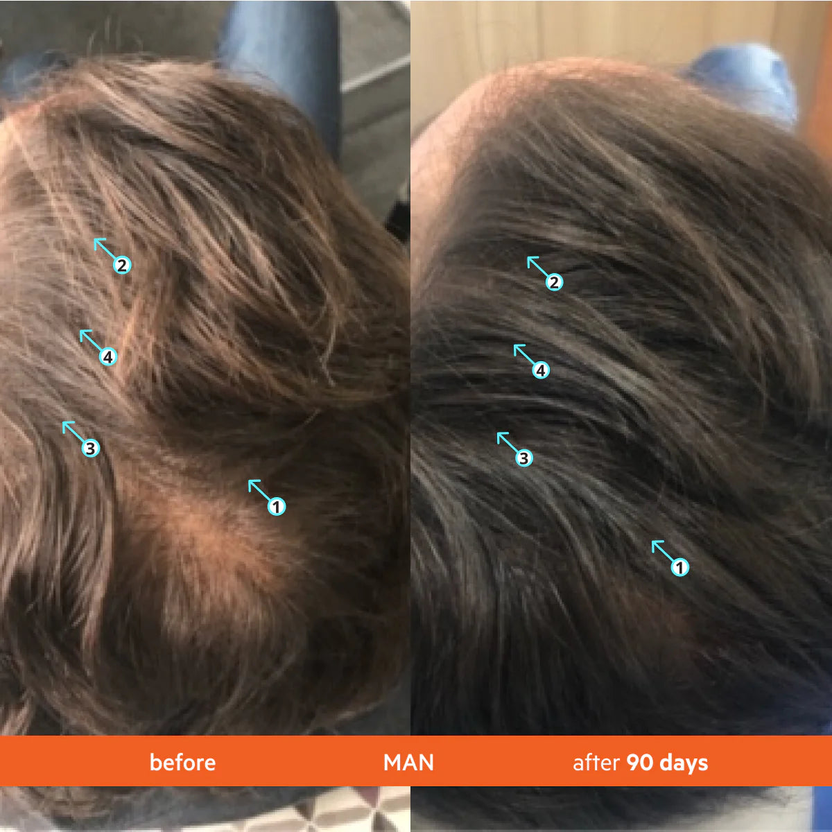 Revita Hair Growth Shampoo Clinically Proven Formula for Thicker, Stronger Hair