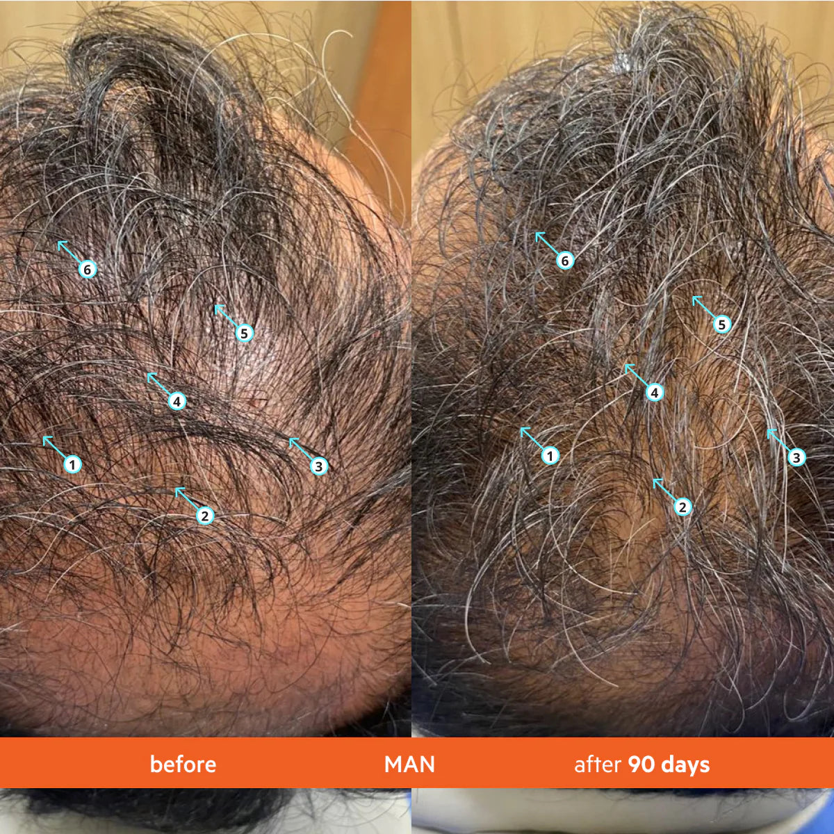 Revita Hair Growth Shampoo Clinically Proven Formula for Thicker, Stronger Hair