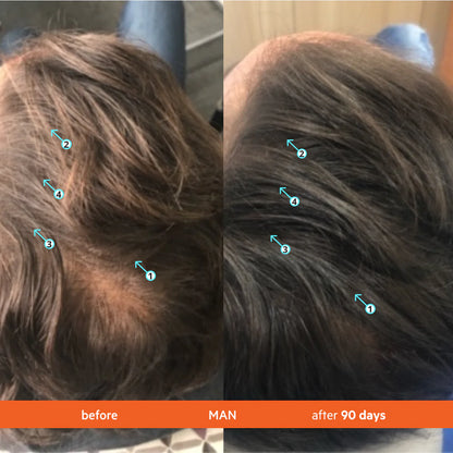 Revita Hair Growth Shampoo Clinically Proven Formula for Thicker, Stronger Hair