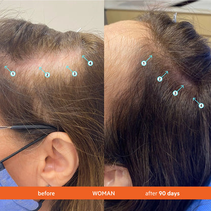 Revita Hair Growth Conditioner – High Performance Strengthening Formula