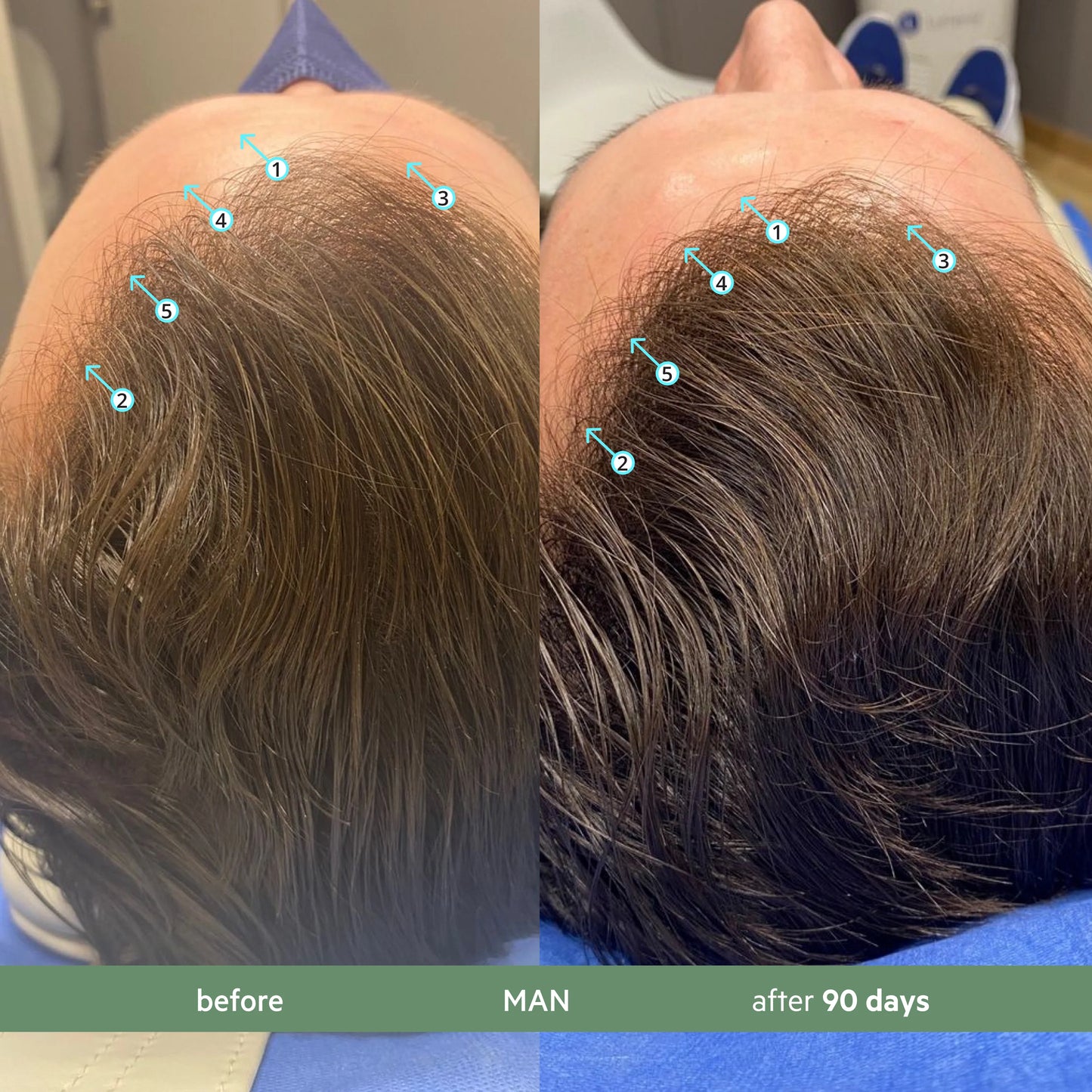 Revita Antioxidant Hair Growth Shampoo – CBD Infused Formula