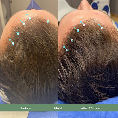 Revita Antioxidant Hair Growth Shampoo – CBD Infused Formula