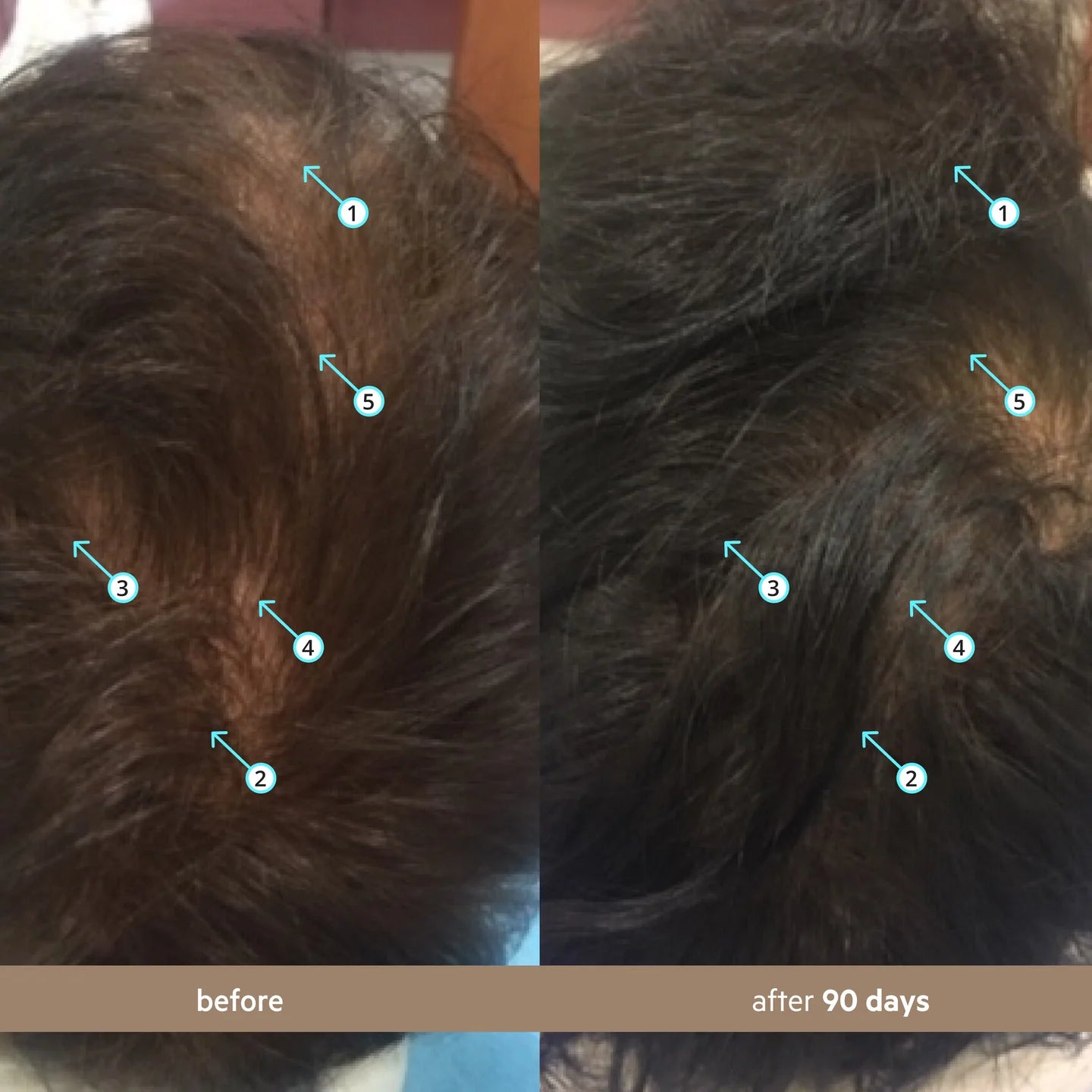 Revita Hair Density Serum – Advanced Growth Formula