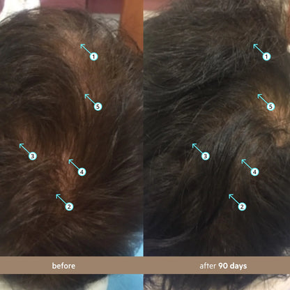 Revita Hair Density Serum – Advanced Growth Formula