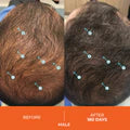 Revita Hair Trio – Shampoo, Conditioner & Gummies