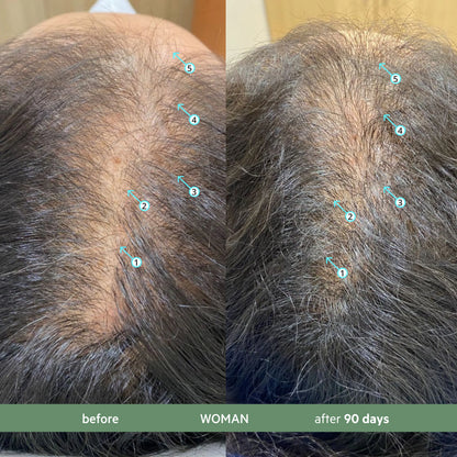 Stronger, Thicker Hair Daily – Revita CBD Repair Conditioner