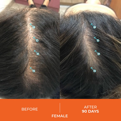 Revita Hair Trio – Shampoo, Conditioner & Gummies