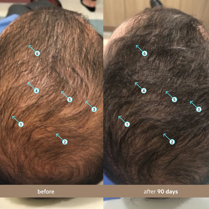 Revita Hair Growth System Kit – Shampoo, Conditioner & Serum