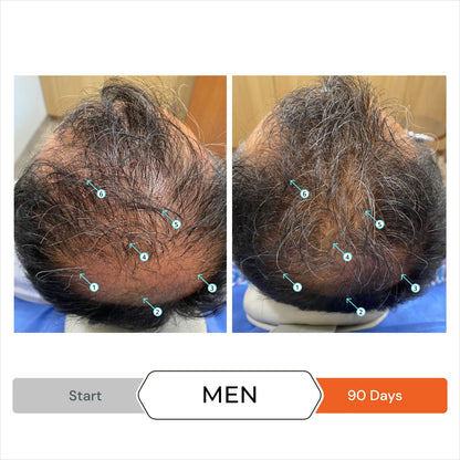 Revita Men’s Hair Regrowth Stimulation Kit